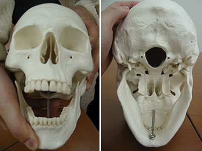 頭蓋骨模型A20、開口の様子
