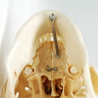 頭蓋骨模型の下顎
