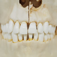 頭蓋骨模型の歯牙