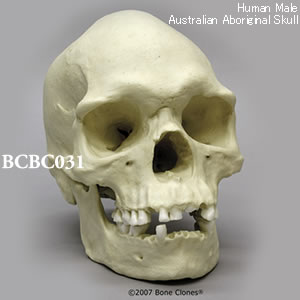BCBC031 オーストラリアアボリジニ男性頭蓋骨模型