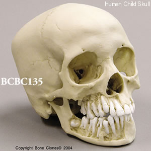 BCBC135 小児頭蓋骨模型　12才・顎開放型
