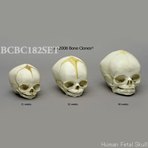 BCBC182SET 胎児頭蓋骨模型　3種セット
