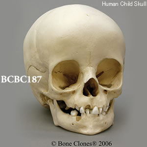 BCBC187 小児頭蓋骨模型　14ヶ月