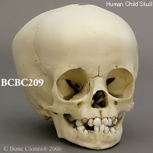 BCBC209 小児頭蓋骨模型　16ヶ月