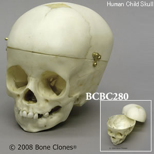 BCBC280 小児頭蓋骨模型　1才・頭蓋冠分離型