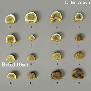 若年成人の癒合椎骨模型　16個セット BCFO110SET  Bone Clones ボーンクローン