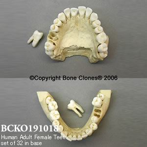 BCKO191018 成人女性歯牙模型（32本組・ベース付）