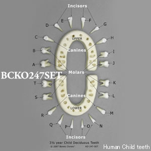 BCKO247SET 小児歯牙模型　4才