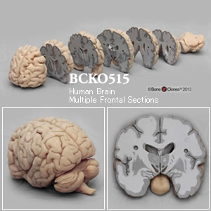BCKO515 ヒト脳の冠状断面７分解模型　マグネット仕様