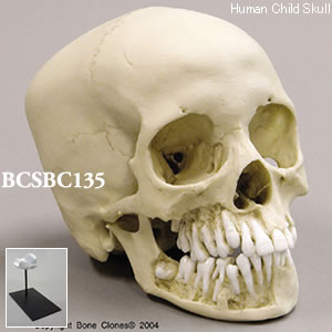 BCSBC135 小児頭蓋骨模型　12才・顎開放型