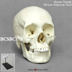 BCSBC178 アフリカ系アメリカ人女性頭蓋骨模型