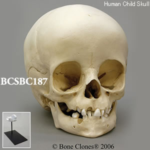 BCSBC187 小児頭蓋骨模型　14ヶ月
