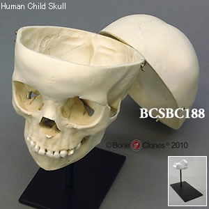 BCSBC188 小児頭蓋骨模型　5才・頭蓋冠分離型