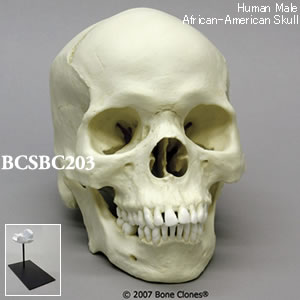 BCSBC203 アフリカ系アメリカ人男性頭蓋骨模型