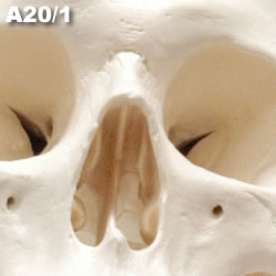 頭蓋骨模型A20/1の顔中心部アップ