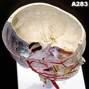 頭蓋骨模型A283、頭蓋底の様子