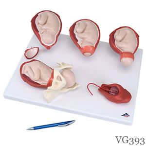 分娩過程、5段階模型 縮尺型　VG393