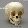 1.5才小児の頭蓋骨模型 BCBC216