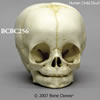 乳児の頭蓋骨模型 4ヶ月乳児 BCBC256