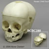 小児の内頭蓋底を観察できる頭蓋骨模型 BCBC280