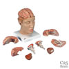 頭部、9分解モデル、動脈、頭蓋底付