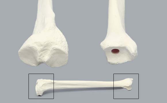 模擬骨・脛骨SAW1126-100の髄内釘挿入口の様子。