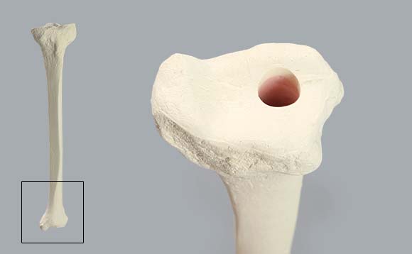 模擬骨・脛骨SAW1126の髄内釘挿入口の様子。