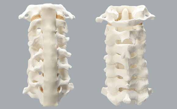 頸椎の模擬骨、正正面と背面