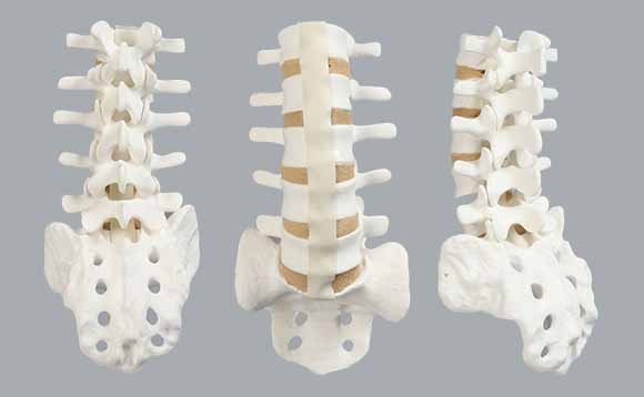 腰椎の模擬骨、正正面と背面