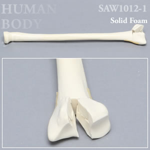 骨折性橈骨（左・中） SAW1012-1 ソーボーン模擬骨