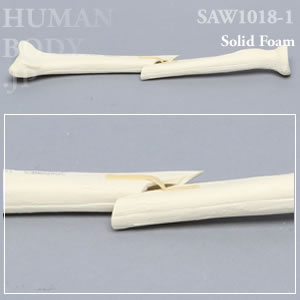 骨折性橈骨（左・大） SAW1018-1 ソーボーン模擬骨