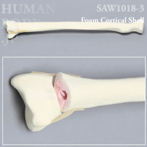 骨折性橈骨（左・大） SAW1018-3 ソーボーン模擬骨