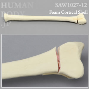 骨折性橈骨（左・大） SAW1027-12 ソーボーン模擬骨