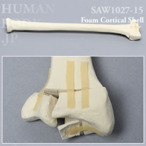 骨折性橈骨（左・大） SAW1027-15 ソーボーン模擬骨