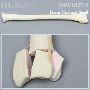 骨折性橈骨（左・大） SAW1027-5 ソーボーン模擬骨
