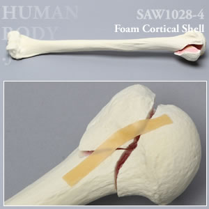 骨折性上腕骨（左・大） SAW1028-4 ソーボーン模擬骨