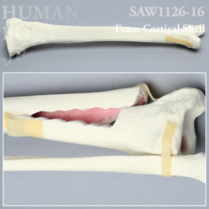 骨折性脛骨と腓骨（左・大） SAW1126-16 ソーボーン模擬骨