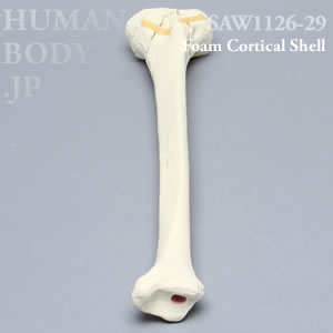 骨折性脛骨（左・大） SAW1126-29 ソーボーン模擬骨