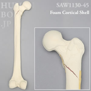 骨折性大腿骨（左・大） SAW1130-45 ソーボーン模擬骨