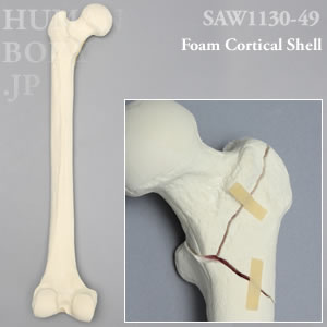 骨折性大腿骨（左・大） SAW1130-49 ソーボーン模擬骨