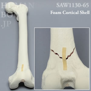 骨折性大腿骨（左・大） SAW1130-65 ソーボーン模擬骨