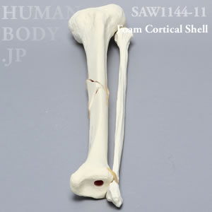 骨折性脛骨と腓骨（左・大） SAW1144-11 ソーボーン模擬骨