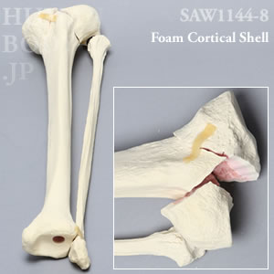 骨折性脛骨と腓骨（左・大） SAW1144-8 ソーボーン模擬骨