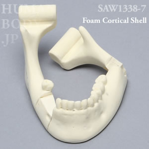 多発骨折性下顎骨（大） SAW1338-7 ソーボーン模擬骨