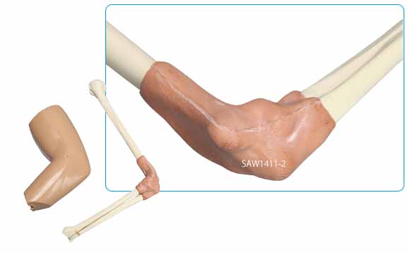 肘関節鏡視下手術シミュレータの骨インサートです。