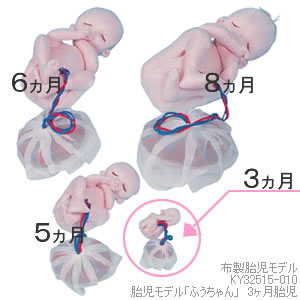 KY32515-010 胎児モデル「ふうちゃん」　12週胎児
