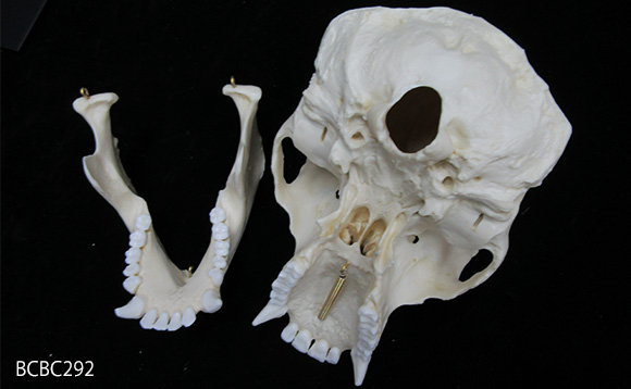 チンパンジーの頭蓋骨模型 BCBC298、分解