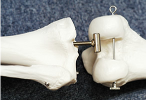 人体骨格模型の膝関節