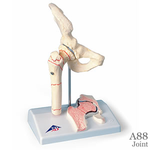大腿骨骨折模型