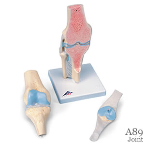 膝の関節断面模型、3分解A89